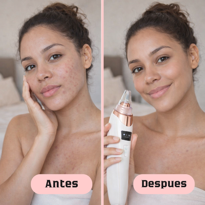 Limpiador Facial 6 en 1